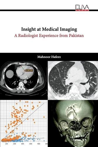 Cover image for Insight at Medical Imaging