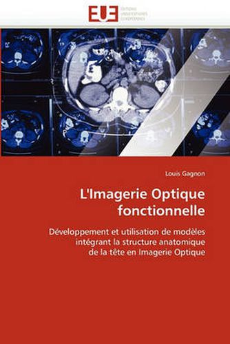 Cover image for L'Imagerie Optique Fonctionnelle