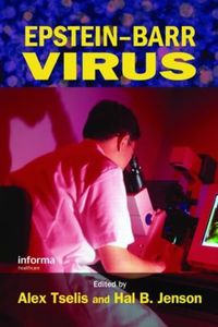 Cover image for Epstein-Barr Virus