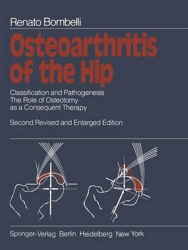 Cover image for Osteoarthritis of the Hip: Classification and Pathogenesis The Role of Osteotomy as a Consequent Therapy