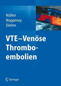 Cover image for VTE - Venoese Thromboembolien