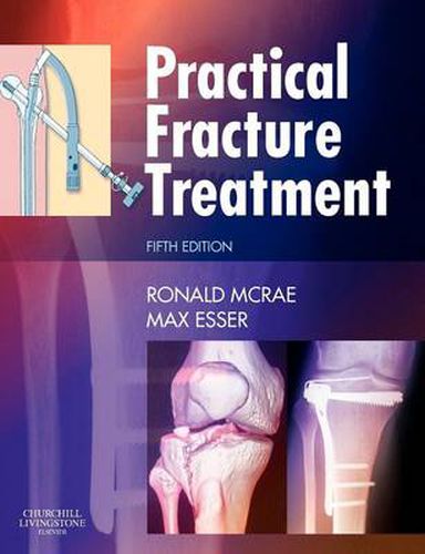 Cover image for Practical Fracture Treatment