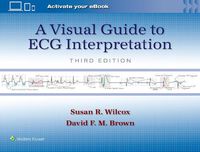 Cover image for A Visual Guide to ECG Interpretation: Print + eBook with Multimedia