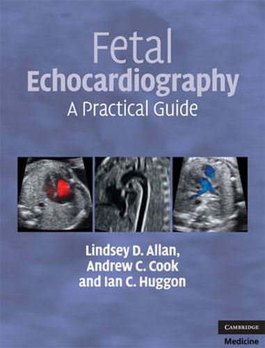 Cover image for Fetal Echocardiography: A Practical Guide