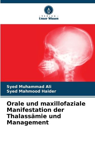 Cover image for Orale und maxillofaziale Manifestation der Thalassaemie und Management