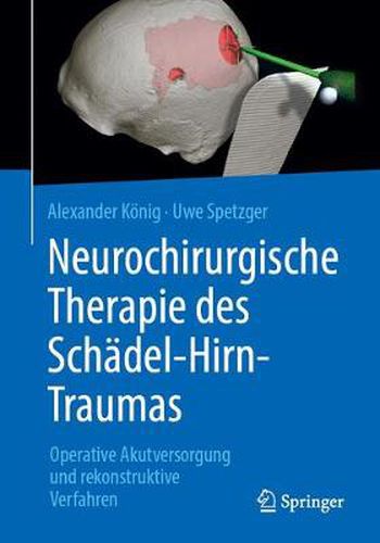 Cover image for Neurochirurgische Therapie Des Schadel-Hirn-Traumas: Operative Akutversorgung Und Rekonstruktive Verfahren