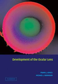 Cover image for Development of the Ocular Lens