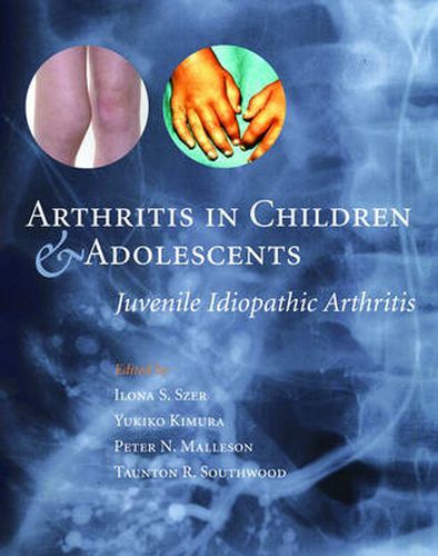 Cover image for Arthritis in Children and Adolescents: Juvenile Idiopathic Arthritis