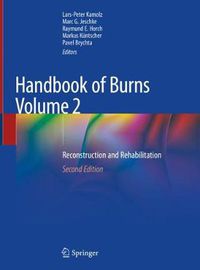 Cover image for Handbook of Burns Volume 2: Reconstruction and Rehabilitation