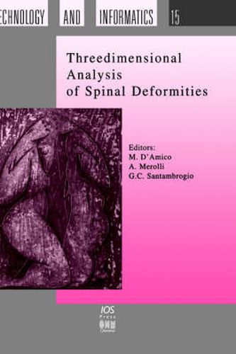 Cover image for Three Dimensional Analysis of Spinal Deformities