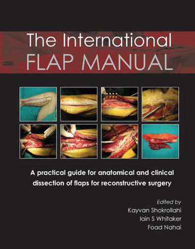 Cover image for International Flap Manual: A Practical Guide for Anatomical & Clinical Dissection of Flaps for Reconstructive Surgery