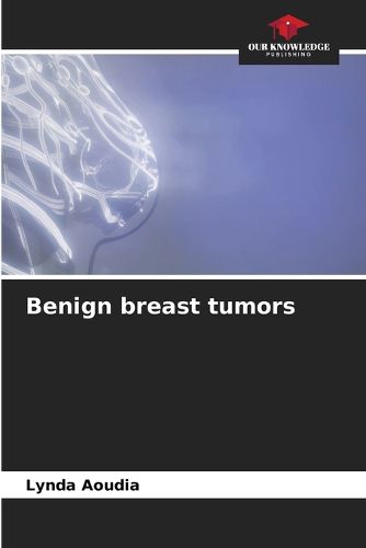 Cover image for Benign breast tumors