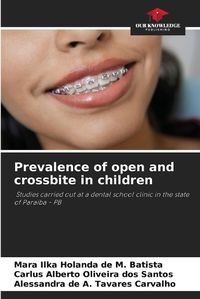 Cover image for Prevalence of open and crossbite in children