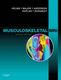 Cover image for Musculoskeletal MRI