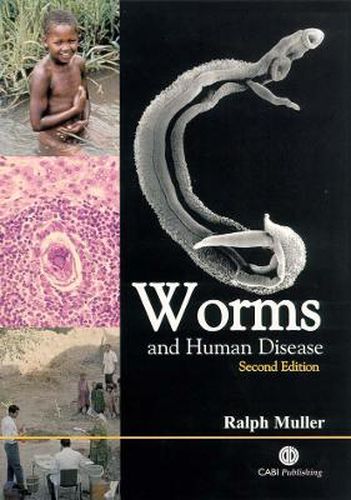 Cover image for Worms and Human Disease
