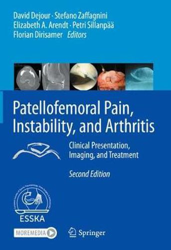 Cover image for Patellofemoral Pain, Instability, and Arthritis: Clinical Presentation, Imaging, and Treatment