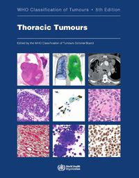 Cover image for Thoracic tumours