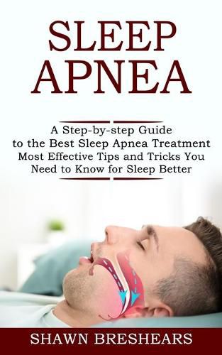 Cover image for Sleep Apnea: A Step-by-step Guide to the Best Sleep Apnea Treatment (Most Effective Tips and Tricks You Need to Know for Sleep Better)