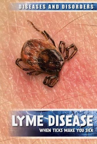 Cover image for Lyme Disease: When Ticks Make You Sick