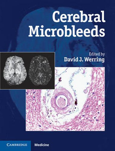 Cover image for Cerebral Microbleeds: Pathophysiology to Clinical Practice