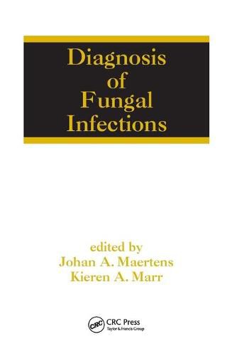 Cover image for Diagnosis of Fungal Infections