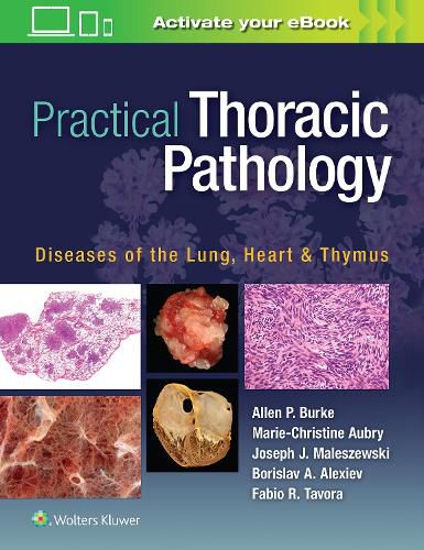 Practical Thoracic Pathology: Diseases of the Lung, Heart, and Thymus