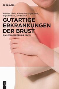 Cover image for Gutartige Erkrankungen Der Brust: Ein Leitfaden Fur Die Praxis