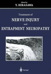 Cover image for Treatment of Nerve Injury and Entrapment Neuropathy