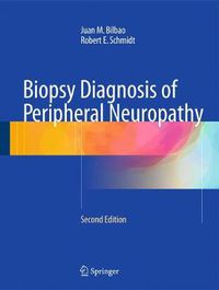 Cover image for Biopsy Diagnosis of Peripheral Neuropathy