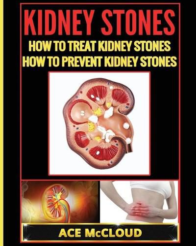 Cover image for Kidney Stones: How To Treat Kidney Stones: How To Prevent Kidney Stones