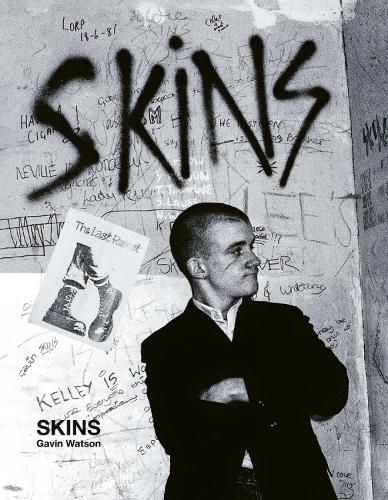 Cover image for Skins