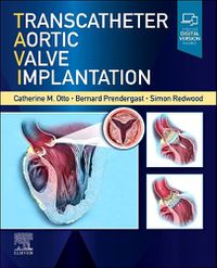 Cover image for Transcatheter Aortic Valve Implantation