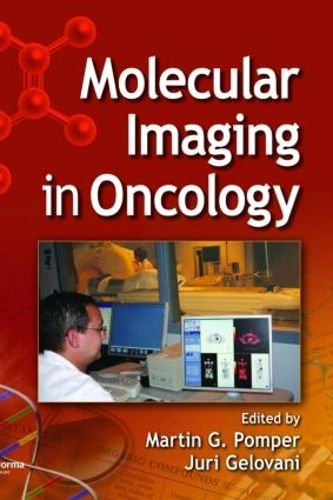 Cover image for Molecular Imaging in Oncology