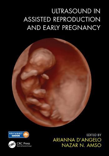 Cover image for Ultrasound in Assisted Reproduction and Early Pregnancy