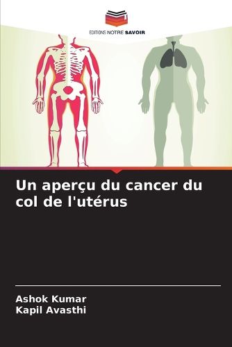 Cover image for Un apercu du cancer du col de l'uterus