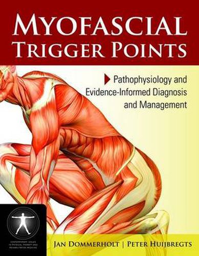 Cover image for Myofascial Trigger Points: Pathophysiology And Evidence-Informed Diagnosis And Management