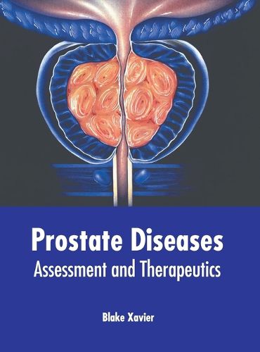 Cover image for Prostate Diseases: Assessment and Therapeutics