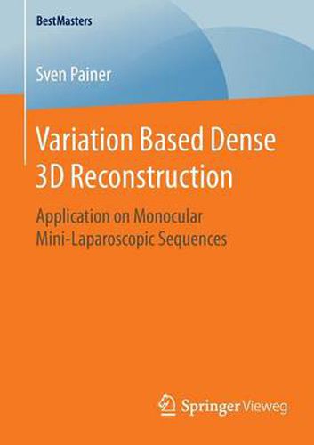 Cover image for Variation Based Dense 3D Reconstruction: Application on Monocular Mini-Laparoscopic Sequences