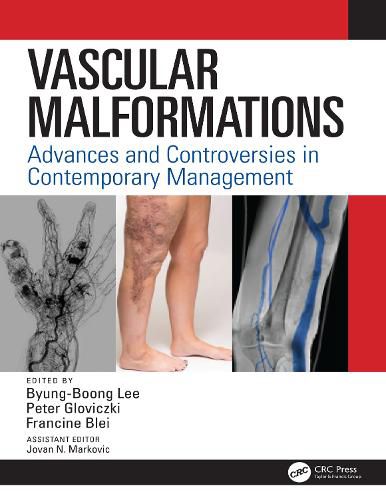 Cover image for Vascular Malformations: Advances and Controversies in Contemporary Management