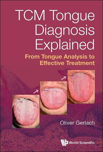 Cover image for Tcm Tongue Diagnosis Explained: From Tongue Analysis To Effective Treatment