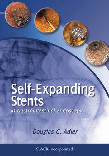 Cover image for Self-Expanding Stents in Gastrointestinal Endoscopy