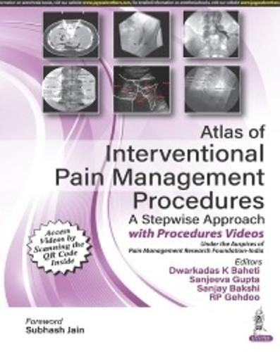 Cover image for Atlas of Interventional Pain Management Procedures
