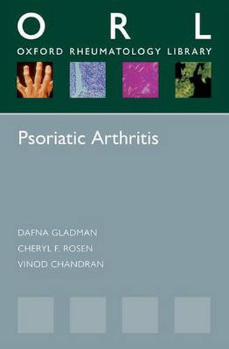 Cover image for Psoriatic Arthritis