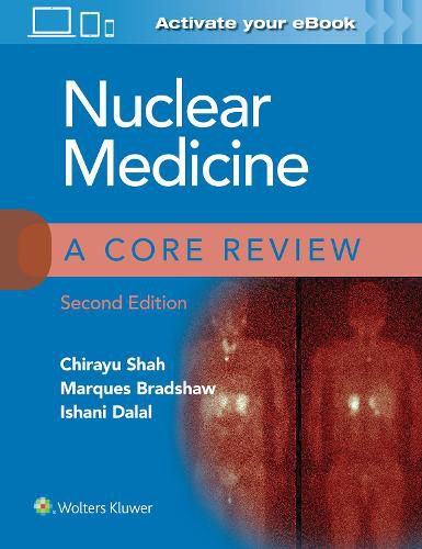 Cover image for Nuclear Medicine: A Core Review