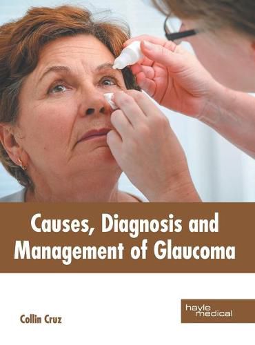 Cover image for Causes, Diagnosis and Management of Glaucoma