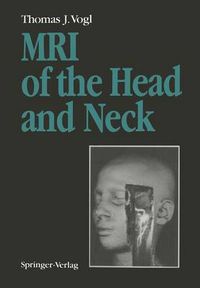 Cover image for MRI of the Head and Neck: Functional Anatomy - Clinical Findings - Pathology - Imaging