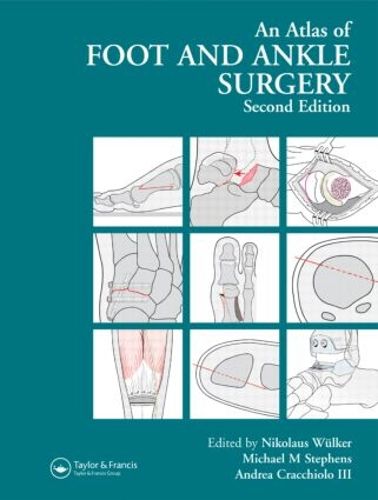 Cover image for Atlas Foot and Ankle Surgery