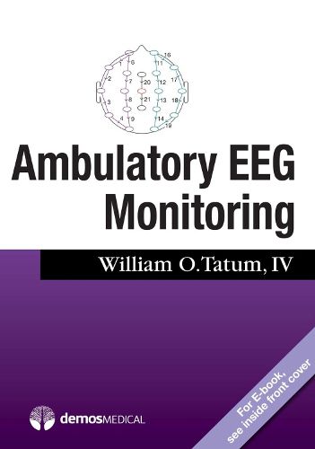 Cover image for Ambulatory EEG Monitoring