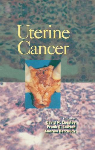 Cover image for Uterine Cancer