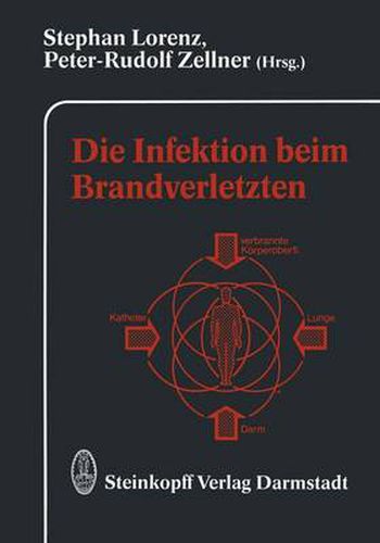 Cover image for Die Infektion Beim Brandverletzten